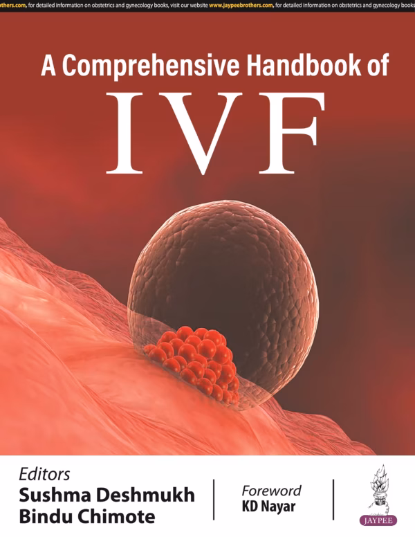 A Comprehensive Handbook of Ivf - 1st Edition