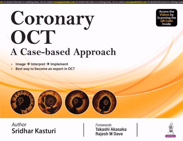 Coronary Oct A Case-Based Approach - 1st Edition Reprint