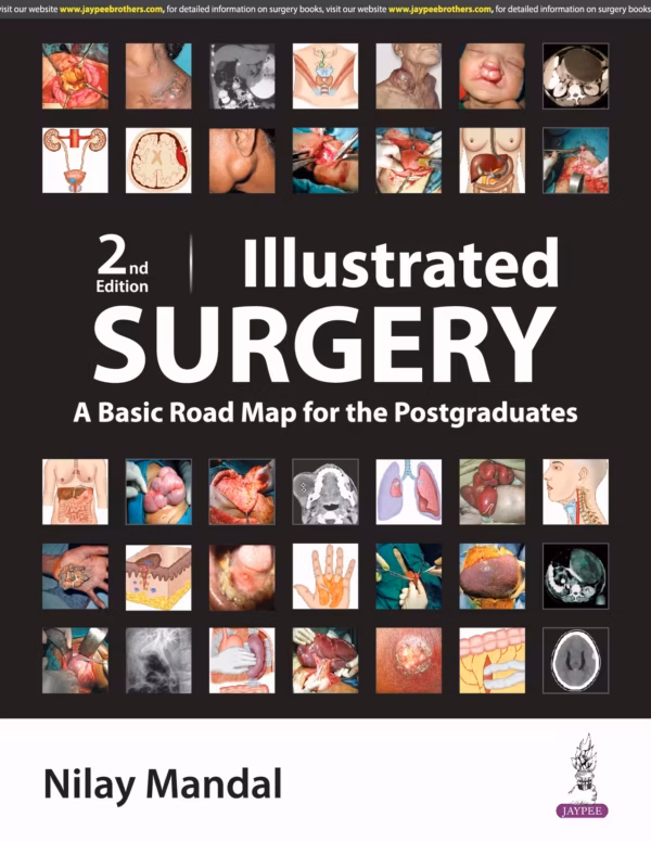 Illustrated Surgery A Basic Road Map for the Postgraduates - 2nd Edition