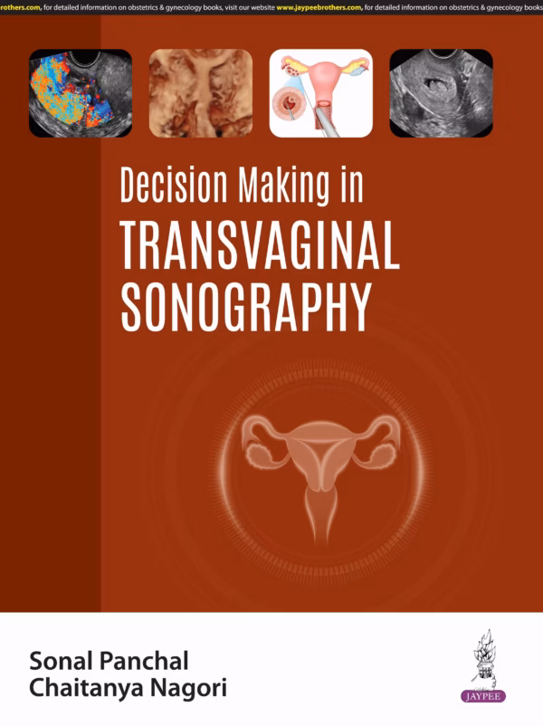 Decision Making in Transvaginal Sonography - 1st Edition