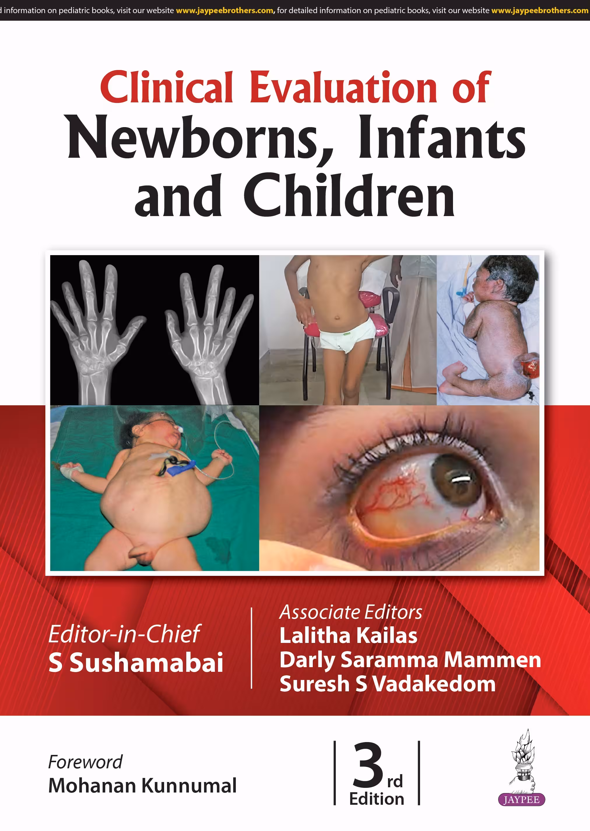 Clinical Evaluation of Newborns, Infants and Children - Third Edition