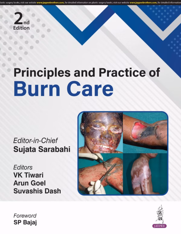 Principles and Practice of Burn Care - 2nd Edition
