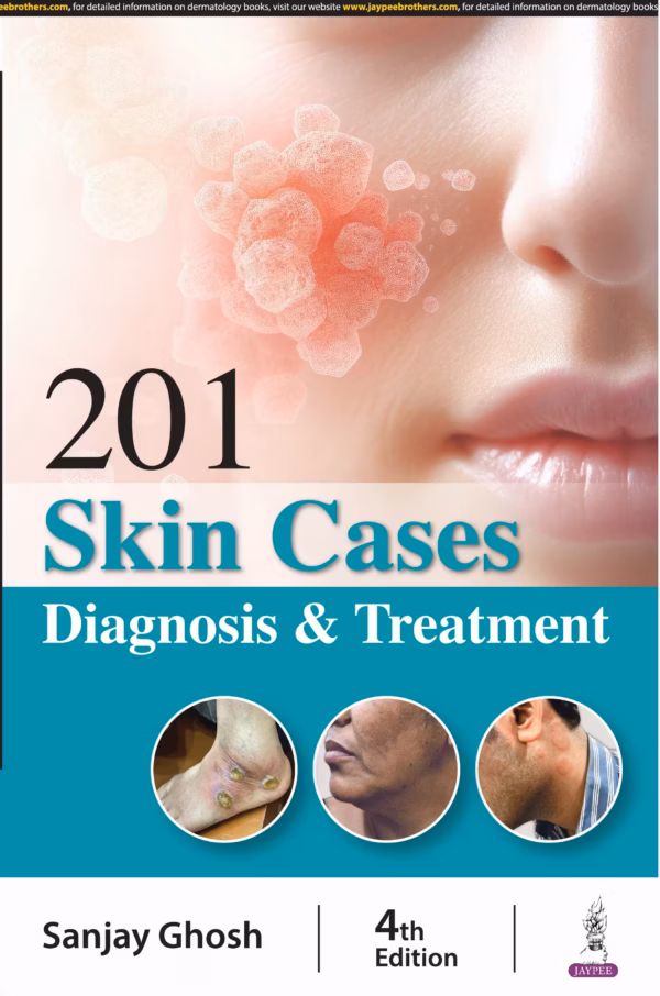 201 Skin Cases Diagnosis & Treatment - 4th Edition