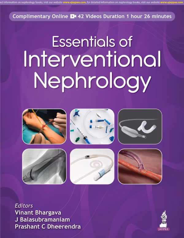 Essentials of Interventional Nephrology - 1st Edition
