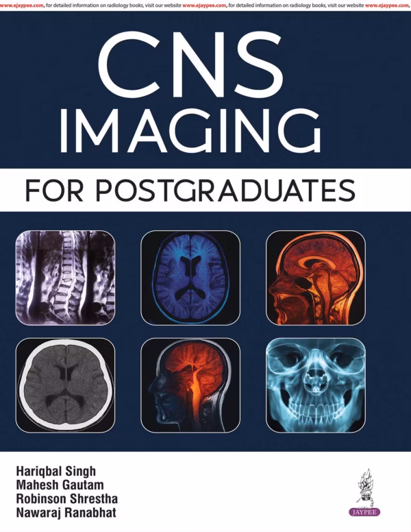 Cns Imaging for Postgraduates - 1st Edition