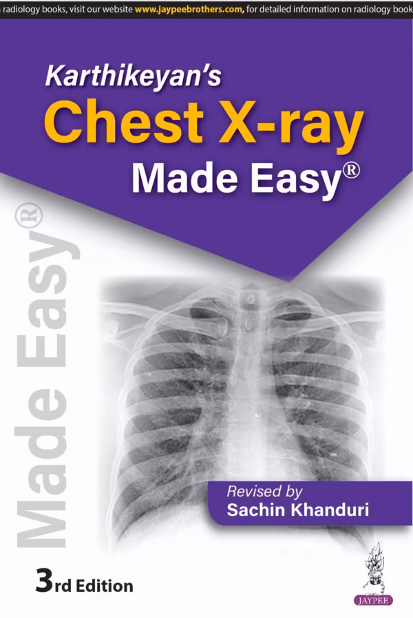 Karthikeyan'S Chest X-Ray Made Easy - Third Edition Reprint