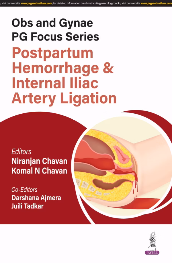 Obs and Gynae Pg Focus Series Postpartum Hemorrhage & Internal Iliac Artery Ligation - 1st Edition