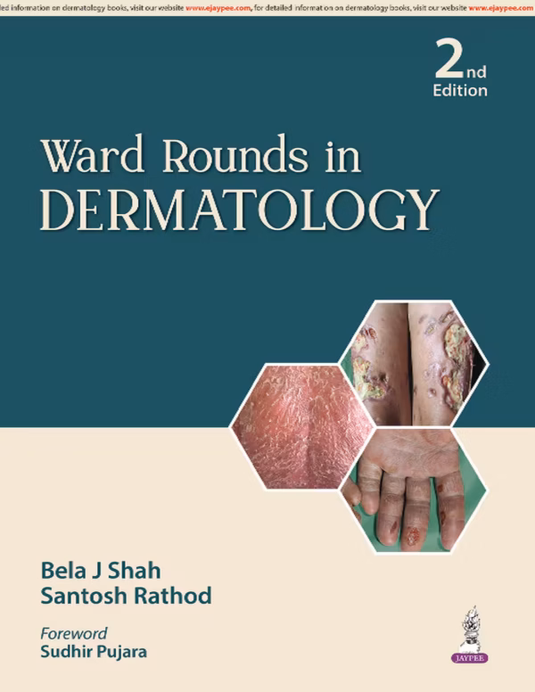Ward Rounds in Dermatology - 2nd Edition