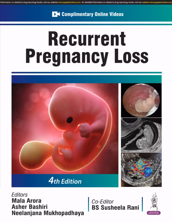 Recurrent Pregnancy Loss - 4th Edition