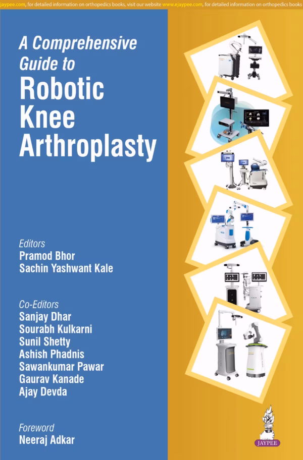 A Comprehensive Guide To Robotic Knee Arthroplasty - 1st Edition