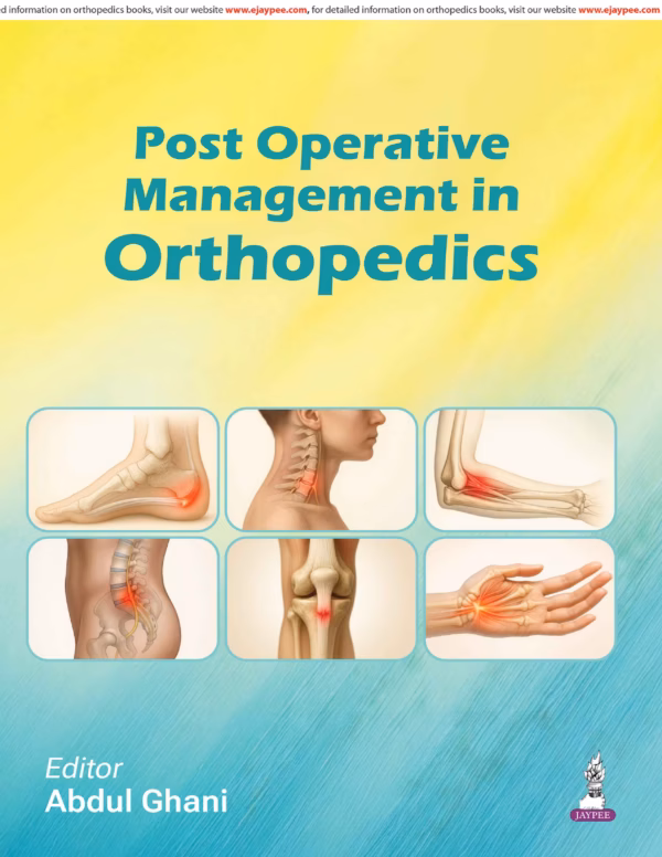 Post Operative Management in Orthopedics - 1st Edition