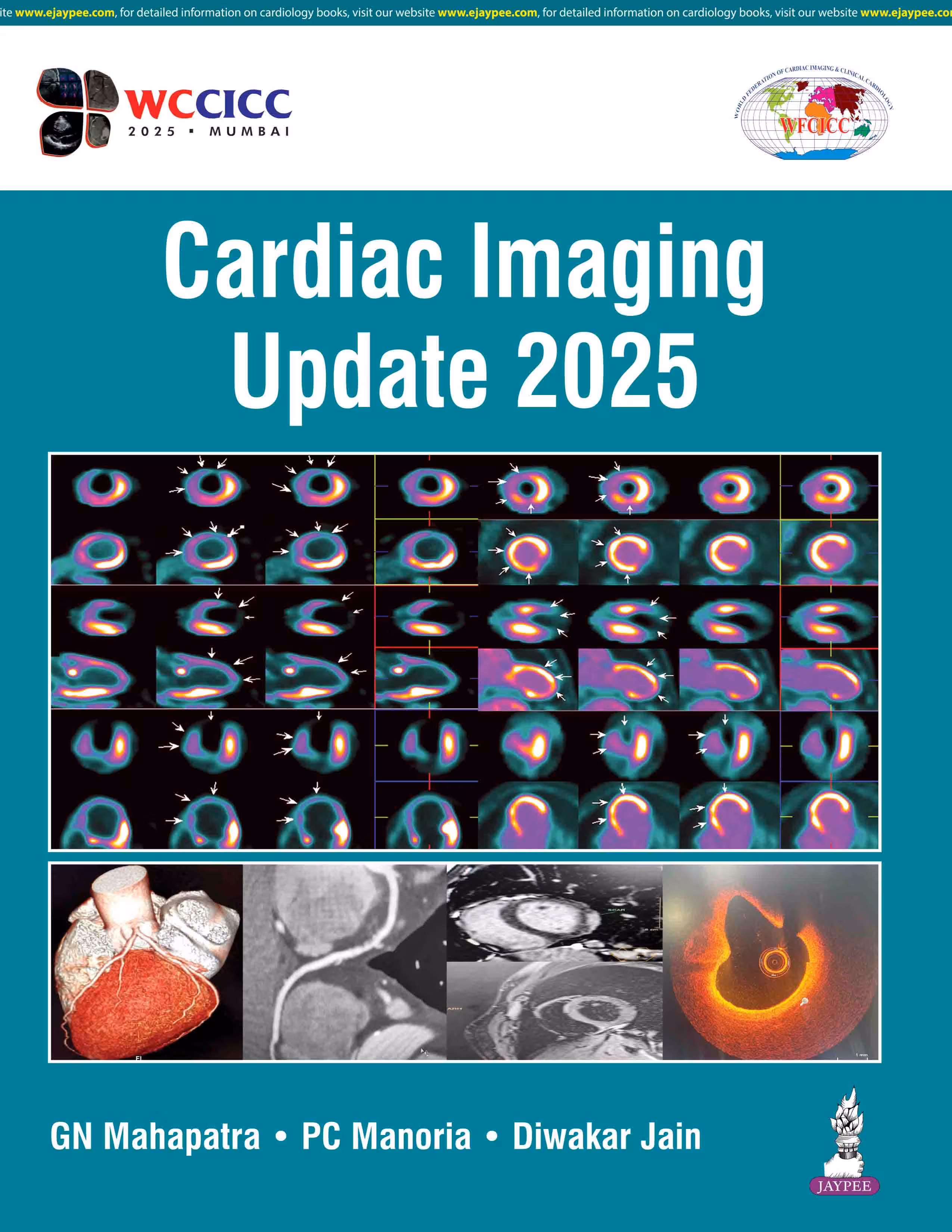Cardiac Imaging Update 2025 - 1st Edition