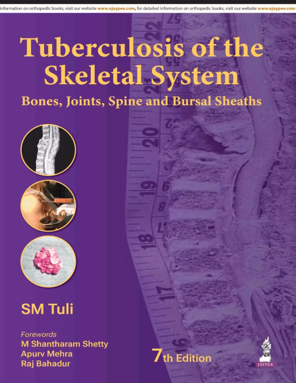 Tuberculosis of the Skeletal System - 7Th Edition