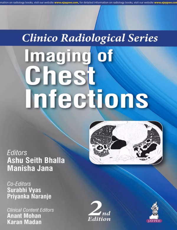Clinico Radiological Series Imaging of Chest Infections - 2nd Edition