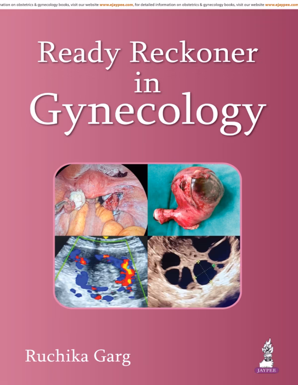 Ready Reckoner in Gynecology - 1st Edition