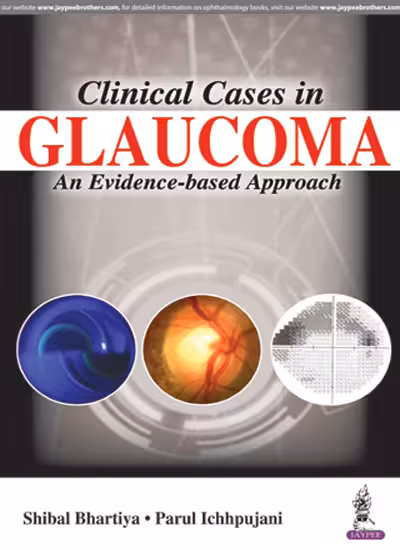 Clinical Cases in Glaucoma An Evidence-Based Approach - 1st Edition