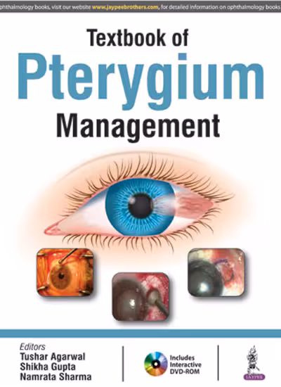 Textbook of Pterygium Management with Dvd-Rom - 1st Edition