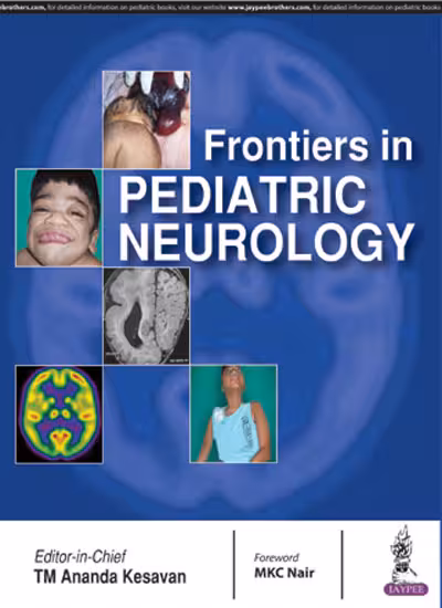 Frontiers in Pediatric Neurology - 1st Edition