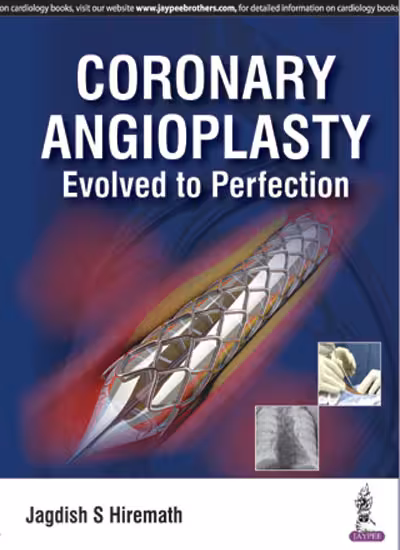 Coronary Angioplasty Evolved To Perfection - 1st Edition