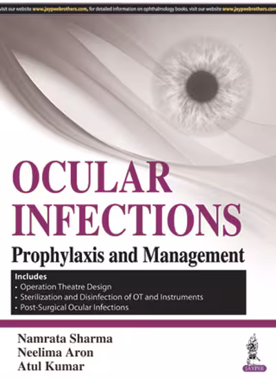 Ocular Infections Prophylaxis and Management - 1st Edition