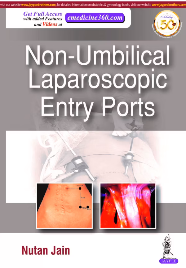 Non-Umbilical Laparoscopic Entry Ports - 1st Edition